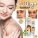 Vitiligo Cream for White Spots On Skin