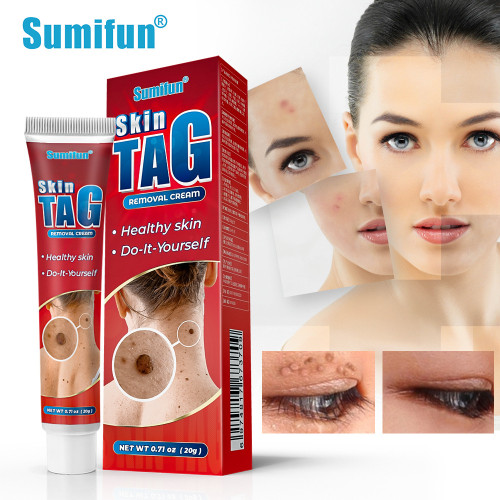 Sumifun Skin Tag Removal Cream,20g