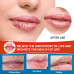 Sumifun Cheilitis Cream for Lips Care