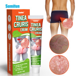 Tinea Cruris Jock Itch Cream