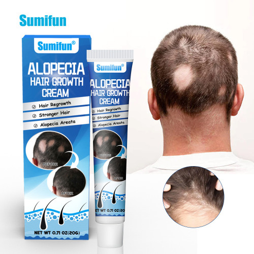 Sumifun Alopecia Hair Growth Cream,20g