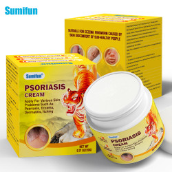 Psoriasis Cream